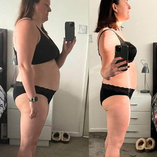 Valerie vorher und nachher
